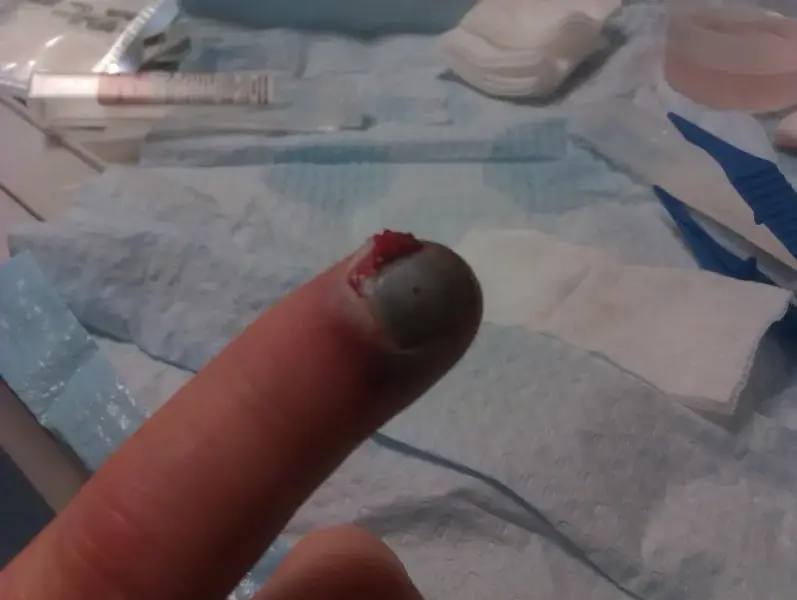 IMAG0286 (Large).webp