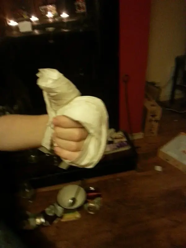 isaacs poorly finger.webp