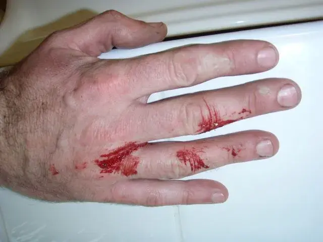 Wear gloves.webp