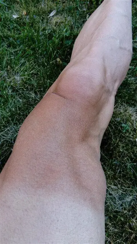 a leg more tired than the left.webp