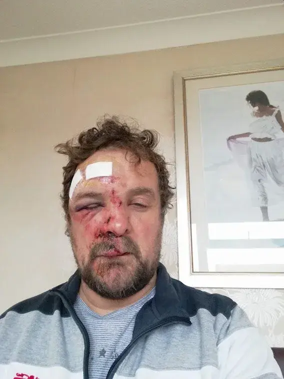 crashface.webp