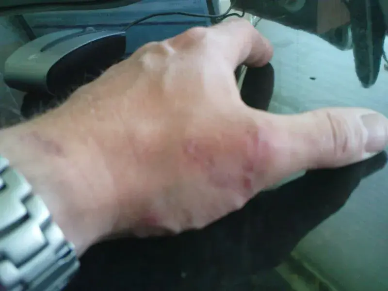 the hand.webp
