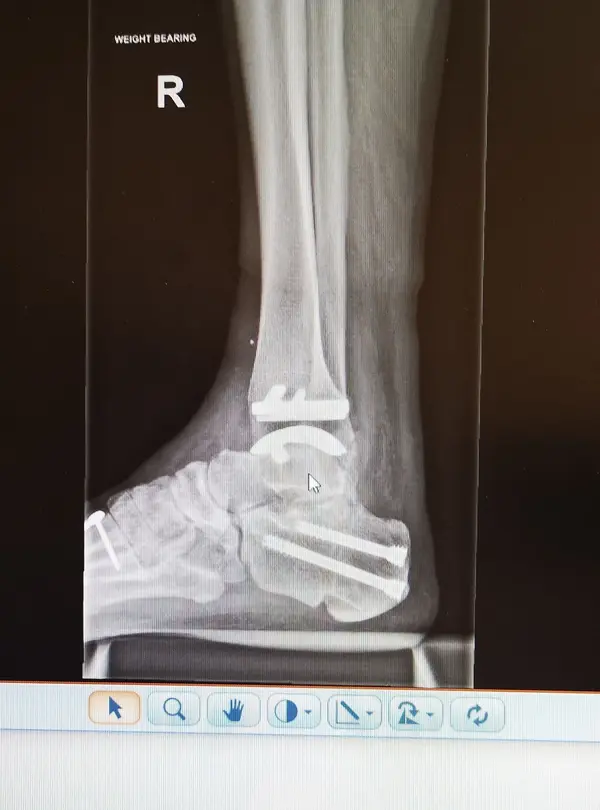 xray1.jpg