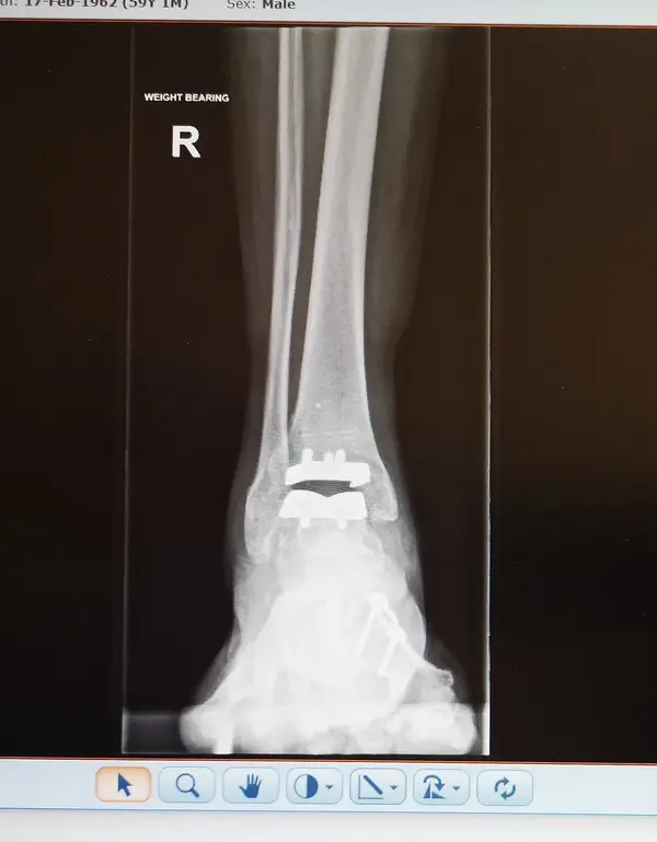 xray2.jpg xray2.jpg