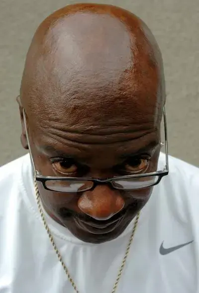 20100228__baldlook2.webp