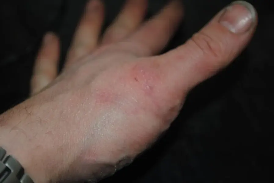 thumb update.webp