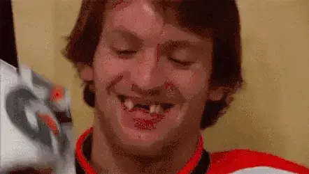 canadian-ice-hockey-player-mathieu-tousignant-smile-missing-teeth-zsqg3uwny08bh8mh.webp