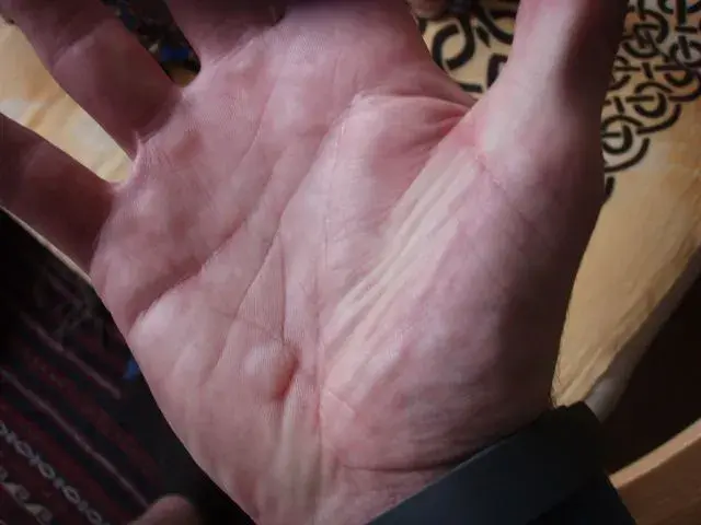 Palm.webp