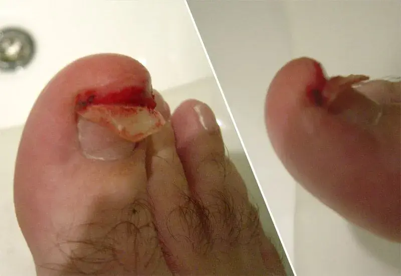 toe03.webp