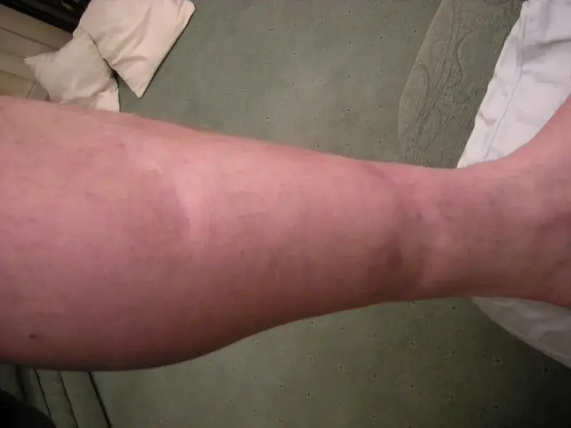 Scar2.webp