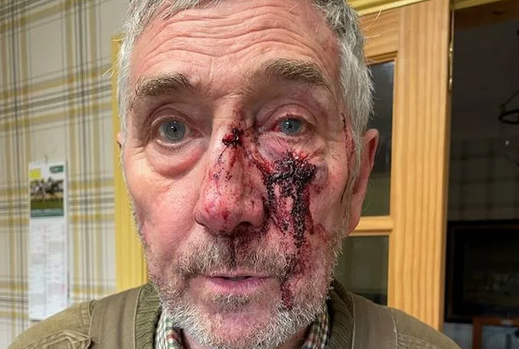 Yorkshire man rushed to hospital after mountain bike trail assault.png