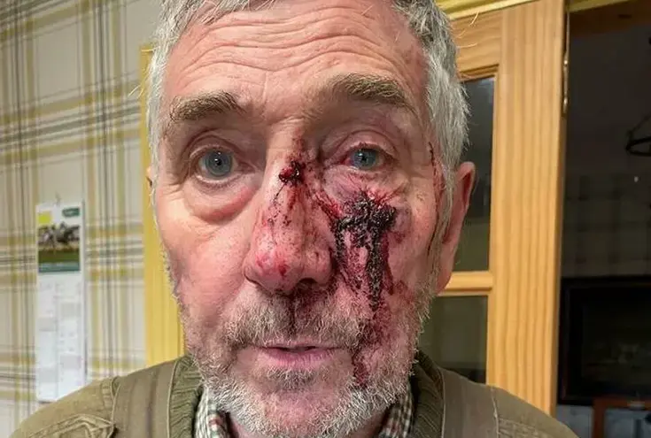 Yorkshire man rushed to hospital after mountain bike trail assault.webp