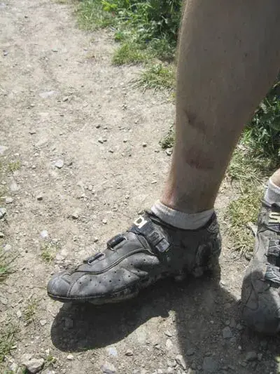 Wounds.webp