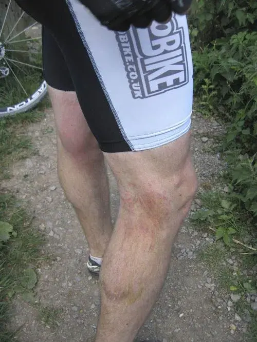 Wounds2.webp