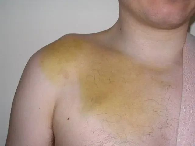Shoulder.webp