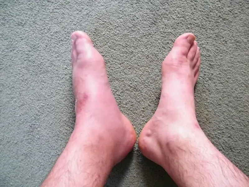 foot 002.webp