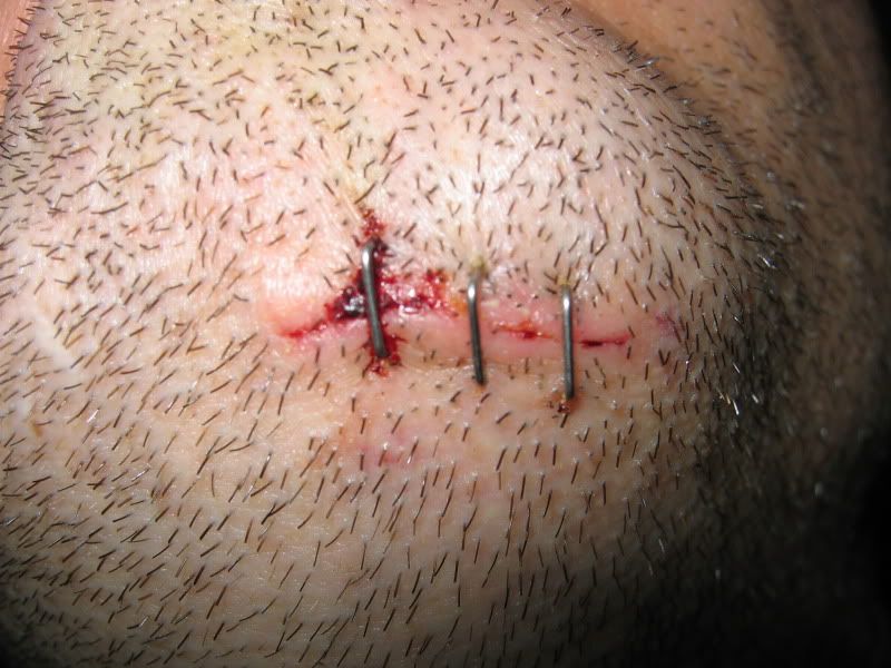 Staples.jpg