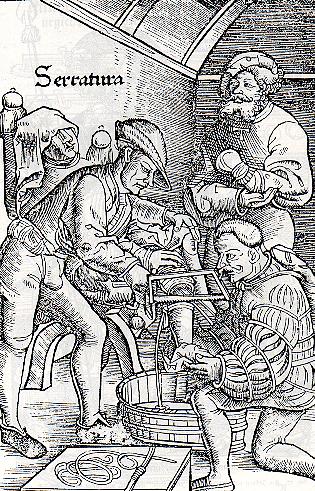 amputation-saw.jpg