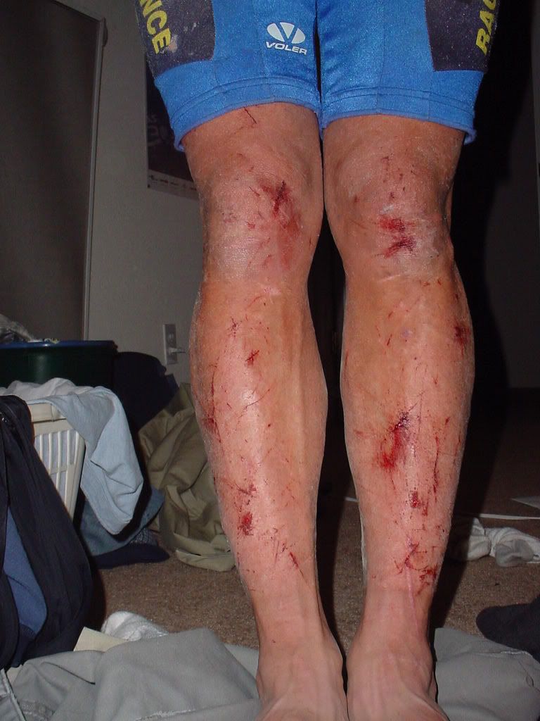 shredded_legs.jpg