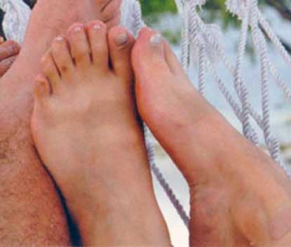 six_toes.jpg