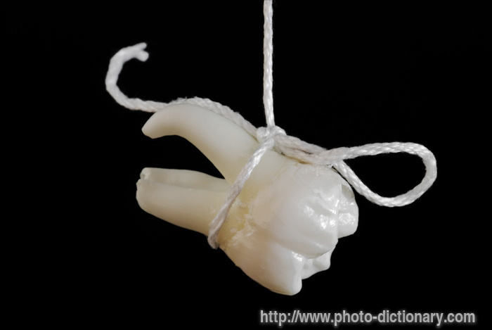 10193tooth_extracting.jpg