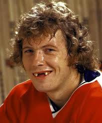 missing-teeth.jpg