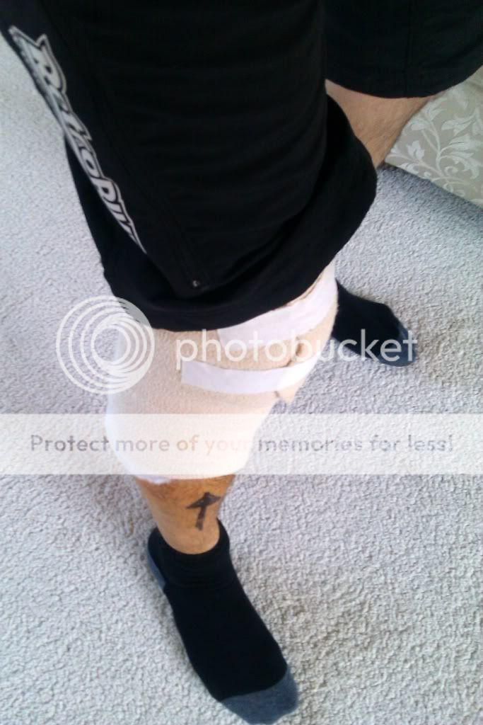 knee.jpg