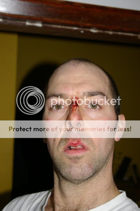 ouch001.jpg